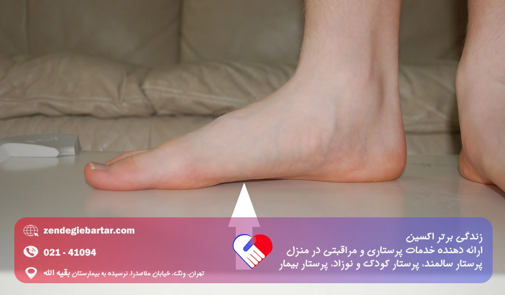 صافی کف پا، درمان خانگی کف پای صاف