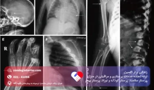 مشکلات اسکلتی کودکان