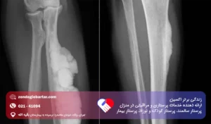 پاژه استخوان