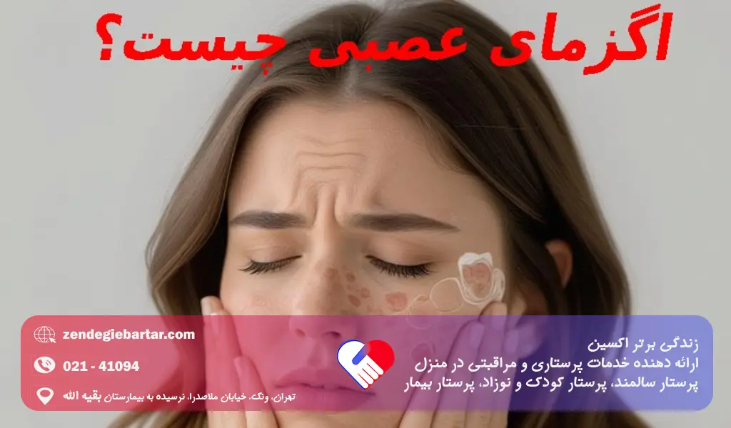 اگزما چیست؟ علائم و روش درمان 3 اگزمای عصبی