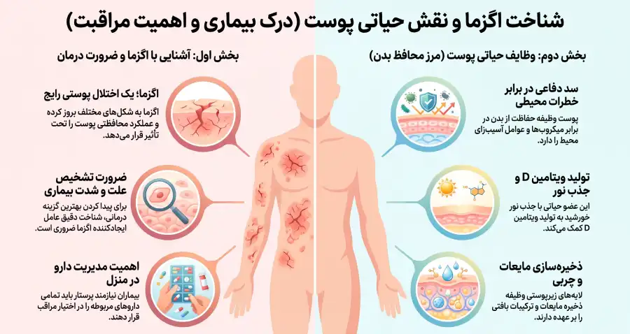 مراقبت از اگزما مراقبت از اگزما