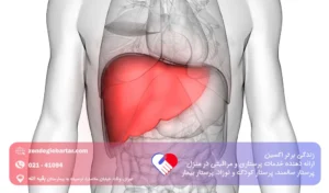 کبد چرب گرید 3 چیست؛ علائم و درمان سریع کبد چرب گرید سه