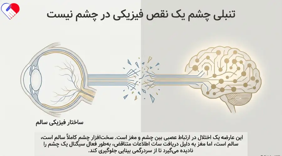 تنبلی چشم نقص فیزیکی نیست تنبلی چشم نقص فیزیکی نیست