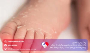 خشکی پوست نوزاد