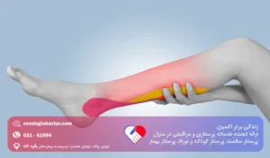 کشیدگی رباط چیست؟