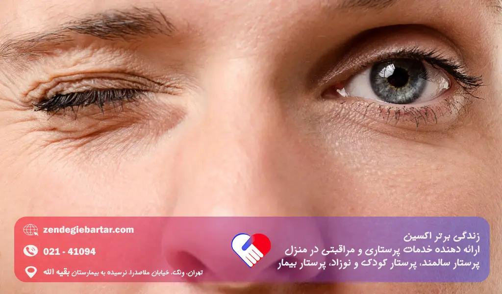 علت نبض زدن پلک بالای چشم چپ 