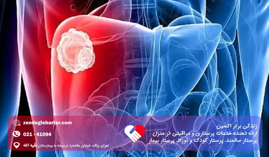 کبود شدن بی دلیل بدن و نشانه های خطرناک 2 علت کبود شدن بی دلیل بدن