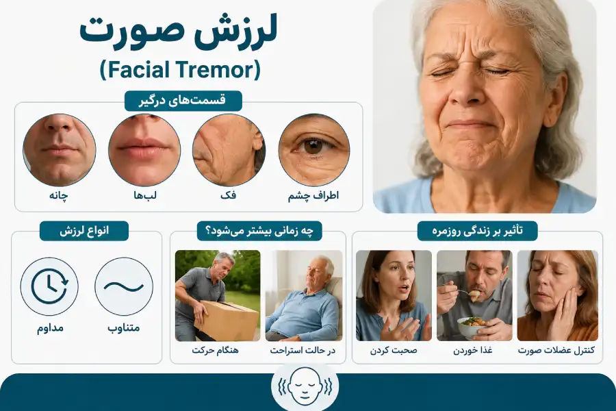 علت چانه در سالمندان علت چانه در سالمندان