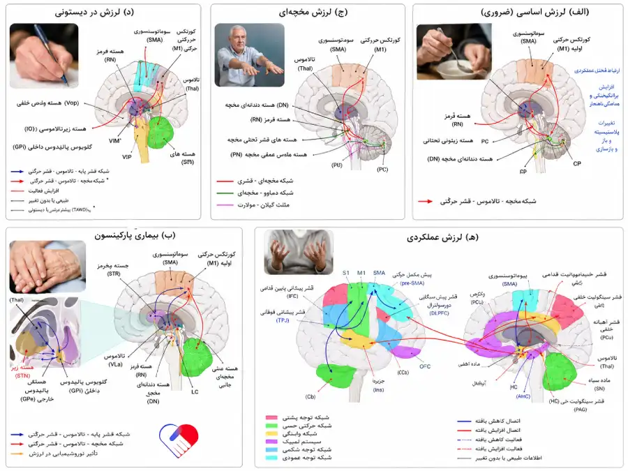 علت لرزش فک پایین در سالمندان علت لرزش فک پایین در سالمندان