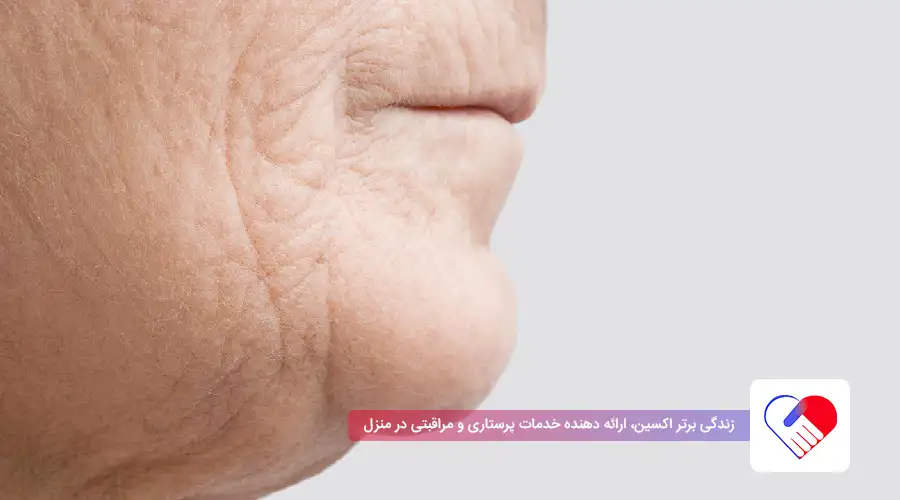 Causes of Parkinson's Disease Causes of Parkinson's Disease