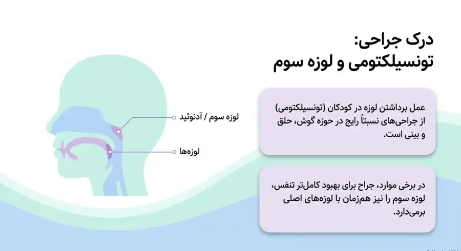 مراقبت های بعد از عمل لوزه در کودکان مراقبت های بعد از عمل لوزه در کودکان